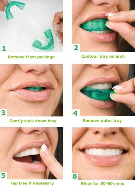 Aktion !!! Opalescence Go 6% 4er Pack von Ultradent