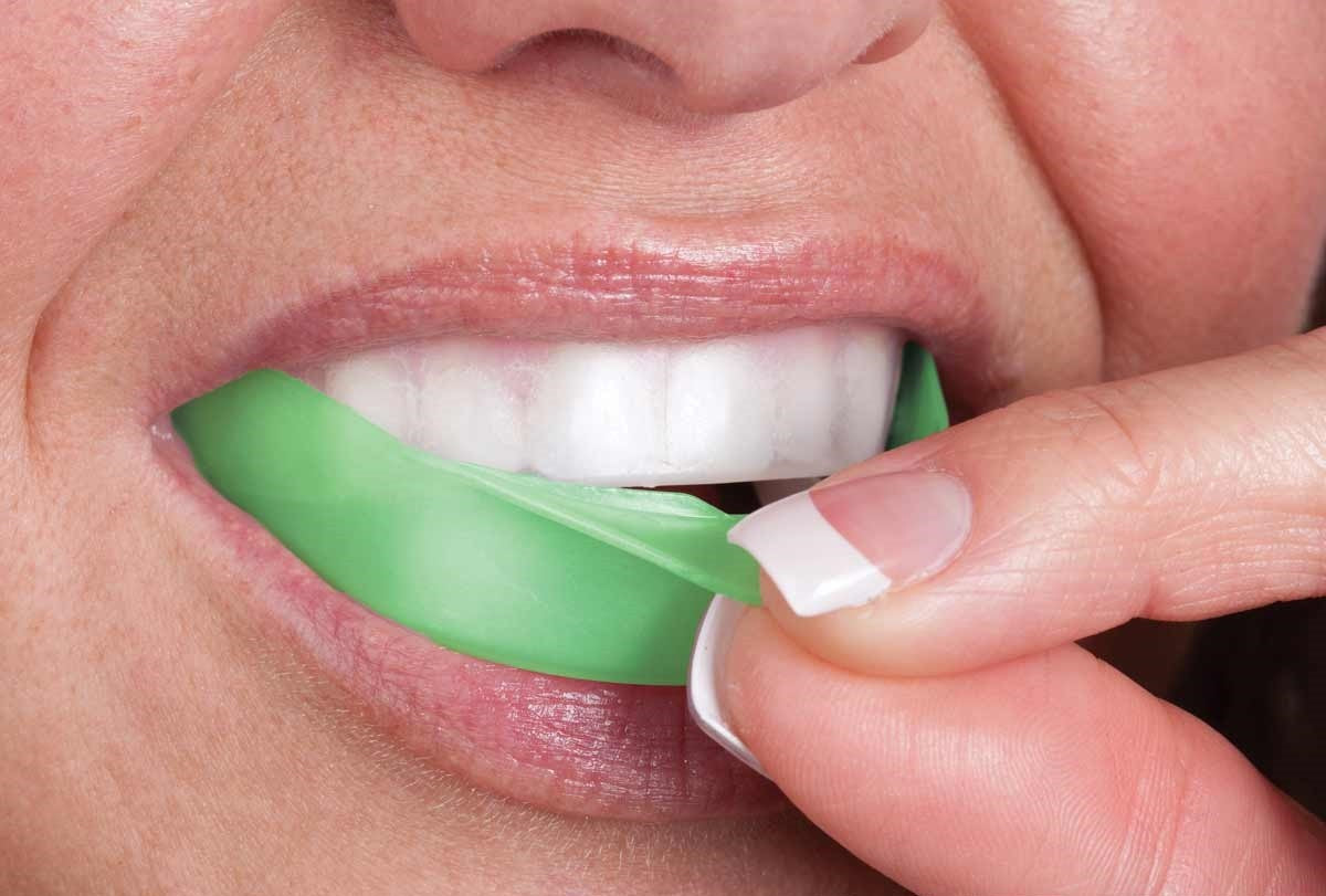 Opalescence Go 6% 10er Pack von Ultradent